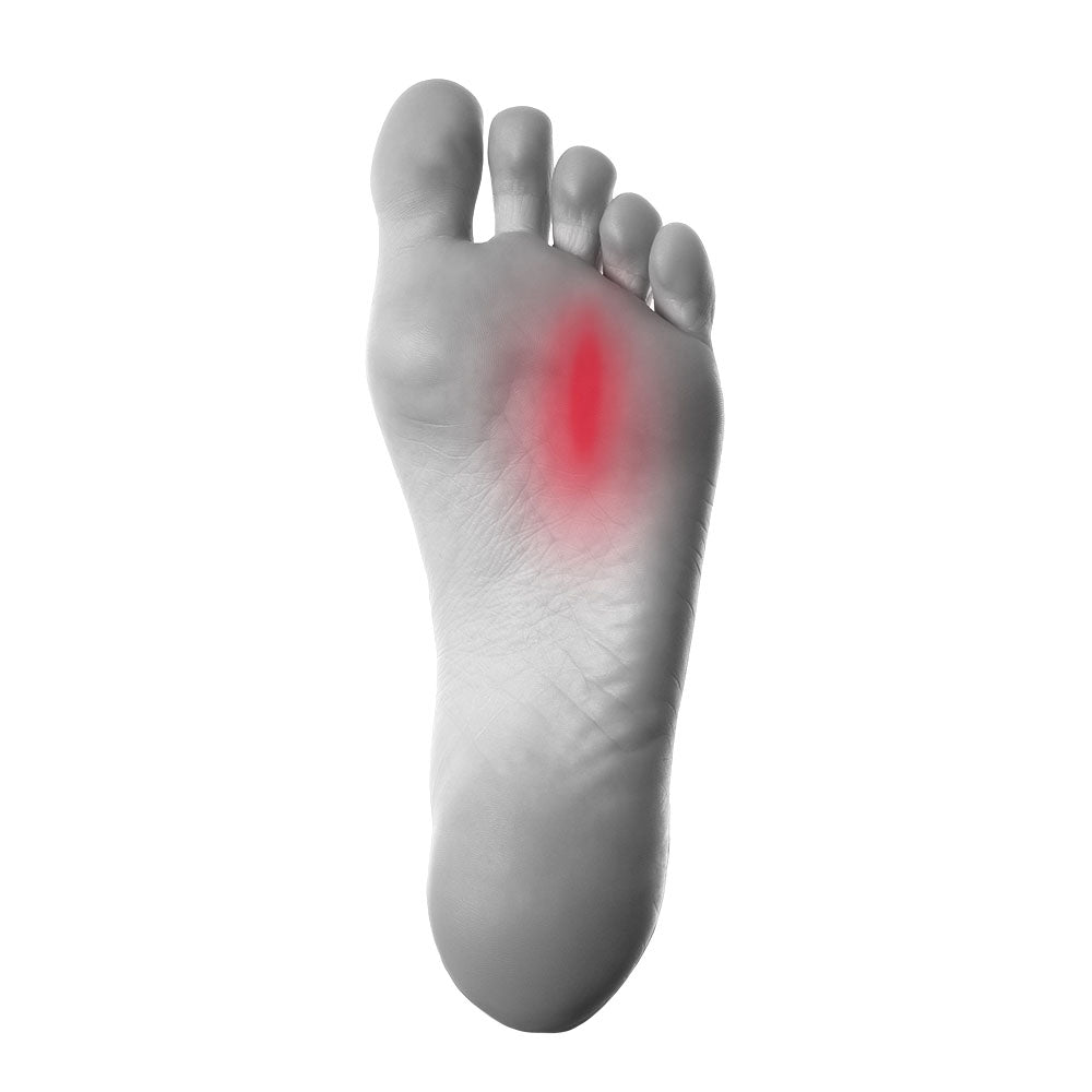 3 Ways Toe Separators Can Relieve Arthritis in Your Feet — Feet&Feet
