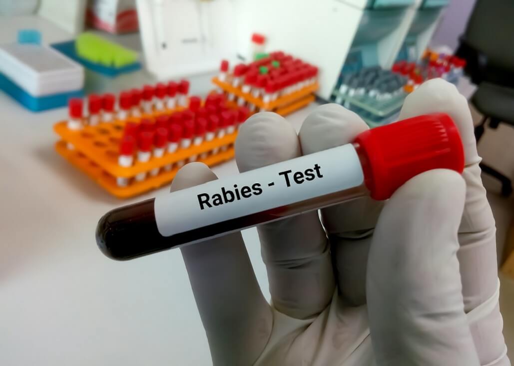 rabies vaccination