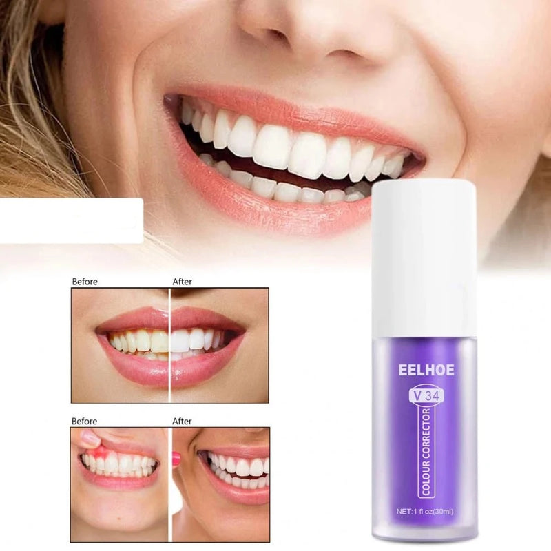 inhoud tempel Wees tevreden ISMIE® | Snelste manier om uw tanden te bleken – ISMIE.NL