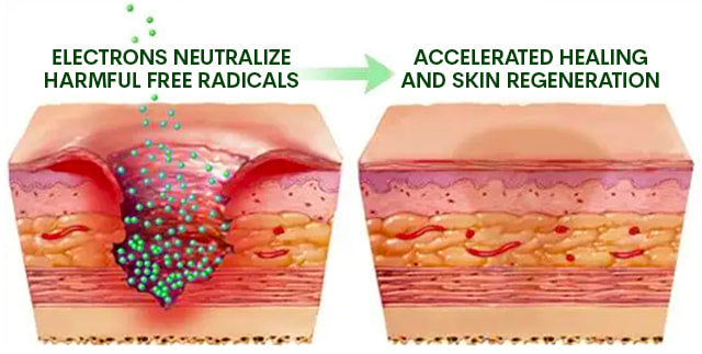 An illustrative image depicting earthing benefits where the intricate process of electrons entering a wound site, effectively neutralizing harmful free radicals that could damage nearby tissues. This electron-driven neutralization process expedites the natural healing mechanisms, facilitating a quicker and more efficient recovery.