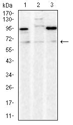 Figure 4:Western blot analysis using CD30 mouse mAb against Hela (1), MCF-7 (2), and HCT116 (3) cell lysate.