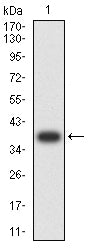 Figure 2:Western blot analysis using ALK/p80 mAb against human ALK/p80 (AA: 1359-1460) recombinant protein. (Expected MW is 37.3 kDa)