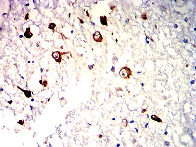 Figure 5:Immunohistochemical analysis of paraffin-embedded human brain tissues using S100A9 mouse mAb with DAB staining.