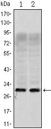 Figure 1: Western blot analysis using TNNI3 Rabbit pAb against Mouse heart (1) and Mouse brain (2) cell lysate.