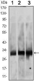 Figure 1: Western blot analysis using BCL-2 Rabbit pAb against K562 (1), Jurkat (2) and THP-1 (3) cell lysate.