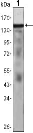 Figure 1: Western blot analysis using Bcr Rabbit pAb against K562 (1) cell lysate.