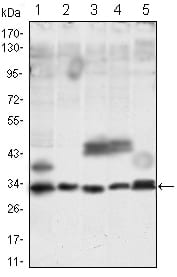 Figure 1: Western blot analysis using COMT Rabbit pAb against HUVE-12 (1), A431 (2), K562 (3), HepG2 (4) cell lysate and spermary tissue (5) lysate.