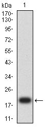 Figure 2:Western blot analysis using MSH2 mAb against human MSH2 (AA: 2-151) recombinant protein. (Expected MW is 19.6kDa)