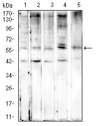 Figure 4:Western blot analysis using KRT6A mouse mAb against Hela (1), MCF-7 (2), SW480 (3), HepG2 (4), and T47D (5) cell lysate.