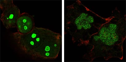 Figure 3: Confocal Immunofluorescence analysis of Hela (left) and NTERA-2 (right) cells using NPM mouse mAb (green). Red: Actin filaments have been labeled with DY-554 phalloidin.