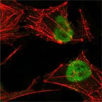 Figure 3: Confocal Immunofluorescence analysis of Hela cells using MSH2 mouse mAb (green), showing nuclear localization. Red: Actin filaments have been labeled with Alexa Fluor-555 phalloidin.