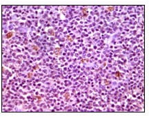 Figure 2: Immunohistochemical analysis of paraffin-embedded human lymphnode tissues using MCL1 mouse mAb with DAB staining.