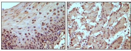 Figure 1: Immunohistochemical staining of paraffin-embedded human normal esophagus (A) and stomach (B) tissue, showing nucleus localization using Rb mouse mAb with DAB staining.