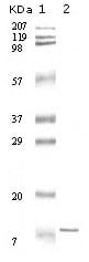 Figure 1: Western blot analysis using IL11 mouse mAb against truncated IL-11 recombinant protein.