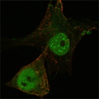 Figure 3: Confocal Immunofluorescence analysis of PANC-1 cells using FOXP3 mouse mAb (green). Red: Actin filaments have been labeled with Alexa Fluor-555 phalloidin.