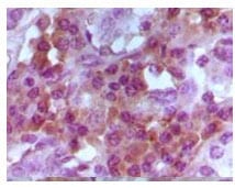 Figure 2: Immunohistochemical analysis of paraffin-embedded human lymphocyto tissue, showing cytoplasmic and nuclear localization using Foxp3 mouse mAb with DAB staining.