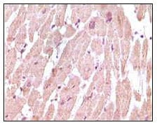 Figure 2: Immunohistochemical analysis of paraffin-embedded human normal cardiac muscle tissue, showing cytoplasmic localization using cTnI mouse mAb with DAB staining.