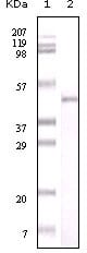 Figure 1: Western blot analysis using Visfatin mouse mAb against truncated Visfatin recombinant protein.