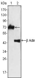 Figure 1: Western blot analysis using ZAP70 mouse mAb against Jurkat cell lysate (1).