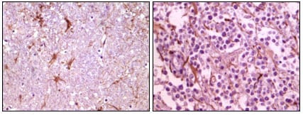 Figure 2: Immunohistochemical analysis of paraffin-embedded human thalamus (left) and glioma (right) tissue, showing membrane localization using CIB1 mouse mAb with DAB staining.