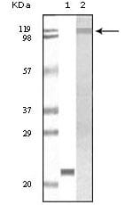 Figure 1: Western blot analysis using TYK2 mouse mAb against truncated TYK2 recombinant protein (1) and Jurkat cell lysate(2).