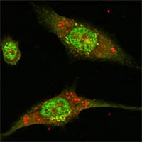 Figure 3: Confocal Immunofluorescence analysis of Eca-109 cells using ERK2 mouse mAb (green).