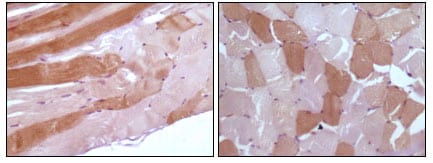 Figure 2: Immunohistochemical analysis of paraffin-embedded human skeletal muscle tissue showing cytoplasmic localization using anti-Myoglobin antibody with DAB staining.