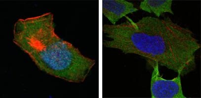 Figure 4: Confocal Immunofluorescence analysis of HepG2 (left) and L-02 (right) cells using GSTP1 mouse mAb (green). Red: Actin filaments have been labeled with DY-554 phalloidin. Blue: DRAQ5 fluorescent DNA dye.
