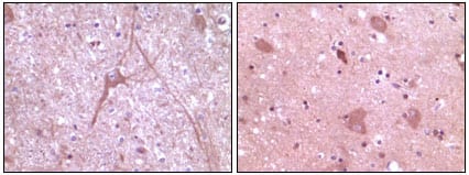 Figure 2: Immunohistochemical analysis of paraffin-embedded human cerebrum tissue (left) and myelencephalon tissue (right), showing cytoplasmic localization using Dynamin2 mouse mAb with DAB staining.