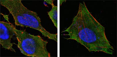 Figure 3: Confocal Immunofluorescence analysis of Hela (left) and L-02 (right) cells using S100A10/P11 mouse mAb(green). Red: Actin filaments have been labeled with DY-554 phalloidin. Blue: DRAQ5 fluorescent DNA dye.