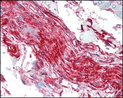 Figure 2: Immunohistochemical analysis of paraffin-embedded human nerve and ganglion cells using S100A10/P11 mouse mAb.