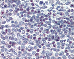 Figure 2: Immunohistochemical analysis of paraffin-embedded human spleen using CD34 mouse mAb with DAB staining.