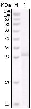 Figure 1: Western blot analysis using HER-2 mouse mAb against truncated HER-2 recombinant protein.