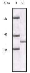 Figure 1: Western blot analysis using P16 mouse mAb against truncated P16 recombinant protein.