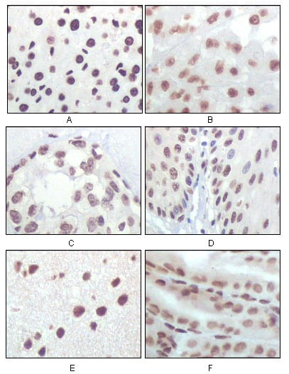 Figure 2: Immunohistochemical analysis of paraffin-embedded rat liver tissue (A), human brain tumor (B), breast cancer (C), esophageal epithelium tissue (D), mouse brain tissue (E) and stomach tisue (F), showing nuclear localization using P16 mouse mAb with DAB staining.