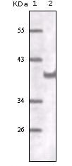 Figure 1: Western blot analysis using CD31 mouse mAb against truncated CD31 recombinant protein.