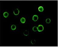 Figure 3: Immunofluorescence analysis of Jurkat cells using BTK mouse mAb.