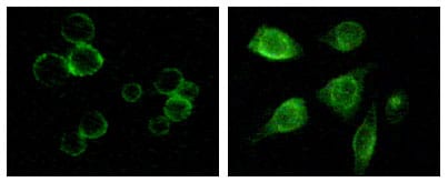 Figure 2: Immunofluorescence staining of methanol-fixed MCF-7 and HepG2 cells showing membrane and cytoplasmic localization.