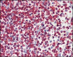 Figure 3: Immunohistochemical analysis of paraffin-embedded human spleen tissues using P16 mouse mAb.