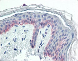 Figure 3: Immunohistochemical analysis of paraffin-embedded human skin tissues using CK5 mouse mAb.