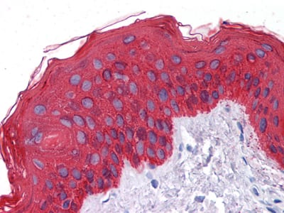 Figure 3: Immunohistochemical analysis of paraffin-embedded human Skin tissues using CK mouse mAb