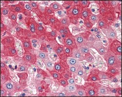 Figure 2: Immunohistochemical analysis of paraffin-embedded human liver tissues using FGFR4 mAb.