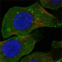 Figure 3: Confocal Immunofluorescence analysis of A549 cells using DDR2 mouse mAb (green). Red: Actin filaments have been labeled with DY-554 phalloidin. Blue: DRAQ5 fluorescent DNA dye.