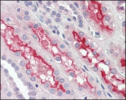 Figure 2: Immunohistochemical analysis of paraffin-embedded human kidney tissues using FER mouse mAb.