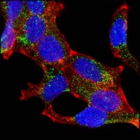 Figure 4: Confocal Immunofluorescence analysis of LNCaP cells using AMACR mouse mAb (green). Red: Actin filaments have been labeled with DY-554 phalloidin. Blue: DRAQ5 fluorescent DNA dye.