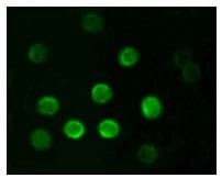 Figure 2: Immunofluorescence analysis of B lymphocytes using CD20 mouse mAb.