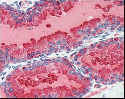 Figure 3: Immunohistochemical analysis of paraffin-embedded human prostate tissues using KLK3 mouse mAb with DAB staining.