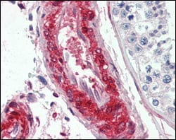 Figure 3: Immunohistochemical analysis of paraffin-embedded human vessels tissues using LPP mouse mAb.