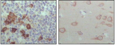 Figure 2: Immunohistochemical analysis of paraffin-embedded human lymph node (left) and brain (right), showing cytoplasmic localization with DAB staining using EhpB6 mouse mAb.