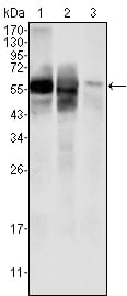 Figure 1: Western blot analysis using GPI mouse mAb against HepG2 (1) , SMMC-7721 (2) cell lysate and rat liver tissues lysate (3).